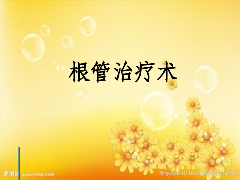 根管治疗术.ppt_第1页