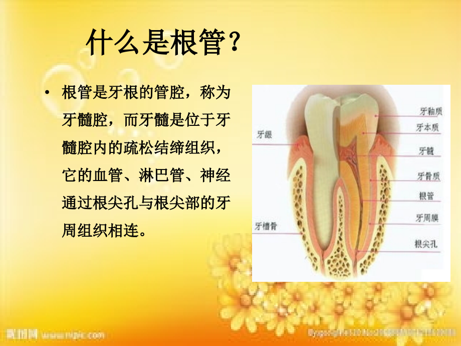 根管治疗术.ppt_第2页
