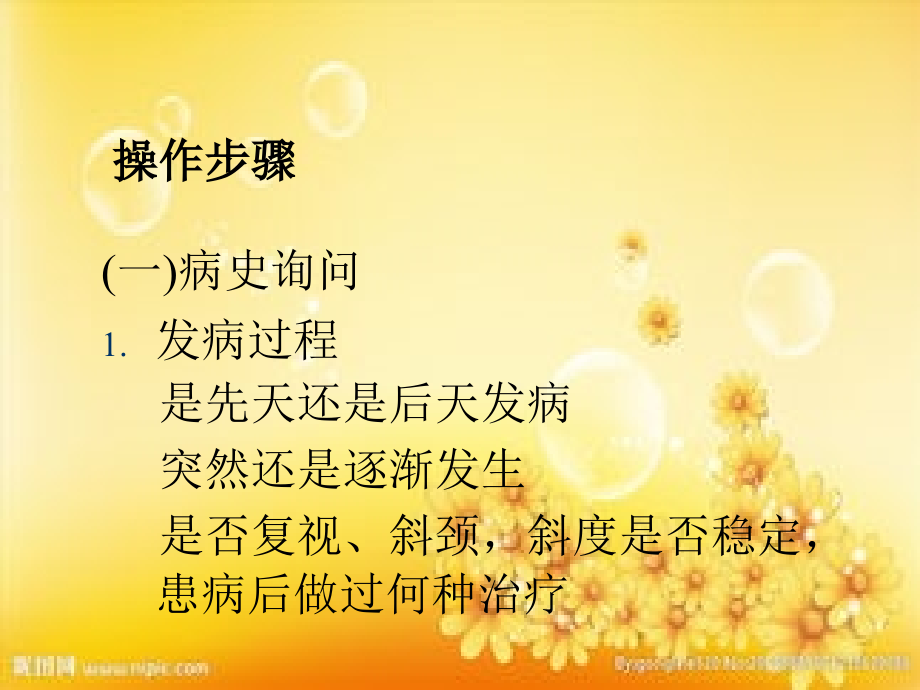 斜视的检查与诊断.ppt_第2页