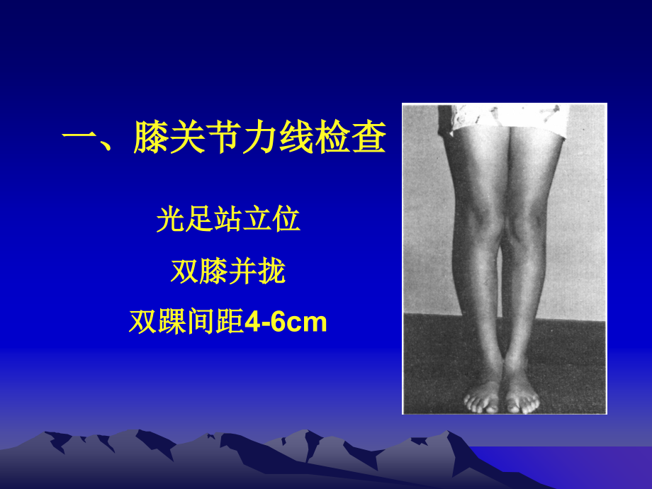 膝关节体检课件.ppt_第2页