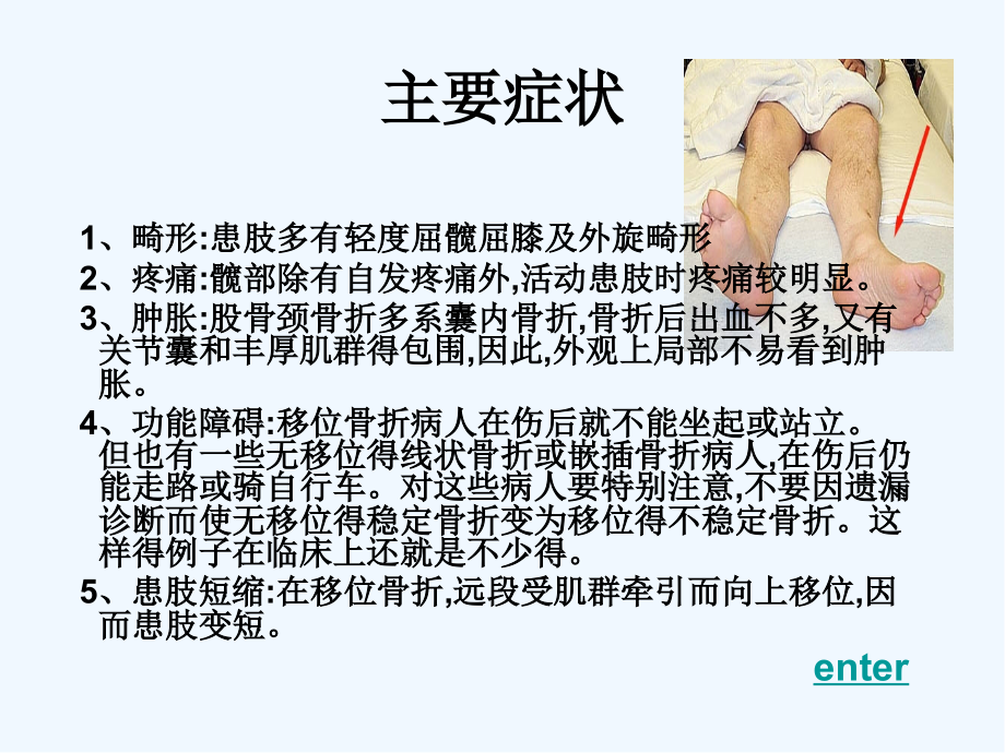 股骨颈骨折的护理演讲稿.pptx_第2页