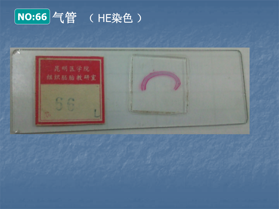 组织胚胎学第六次实习(2010-4-19).ppt_第2页