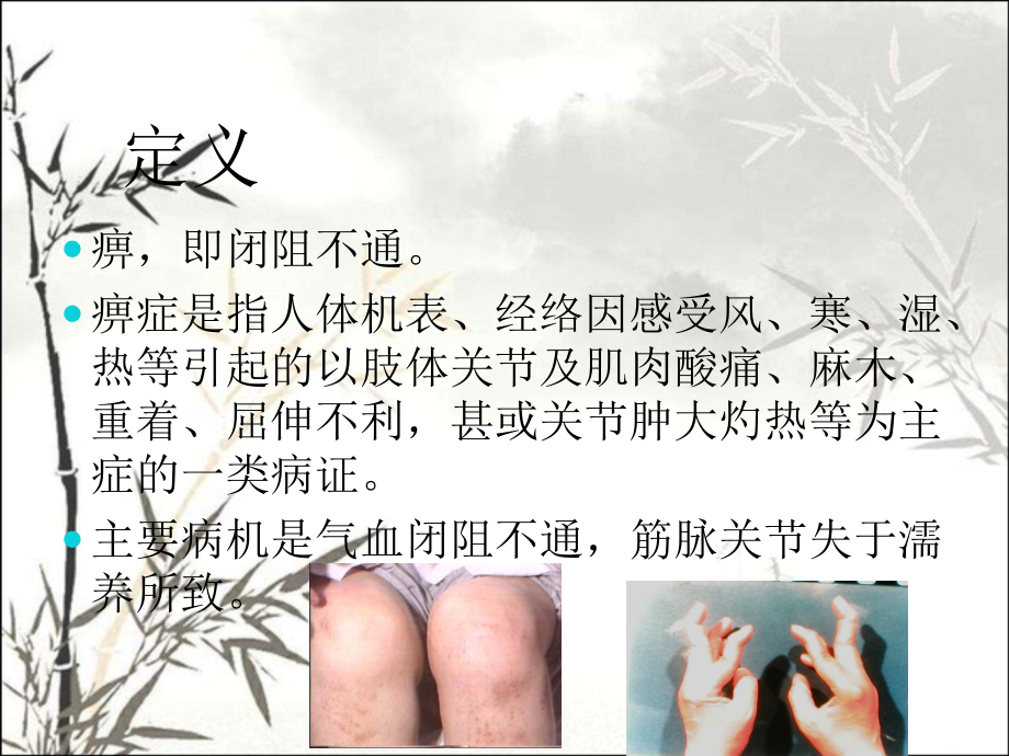 中医痹症.ppt_第2页