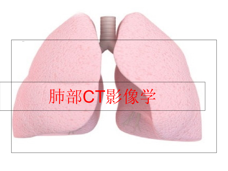 胸部CT全部介绍.pptx_第1页