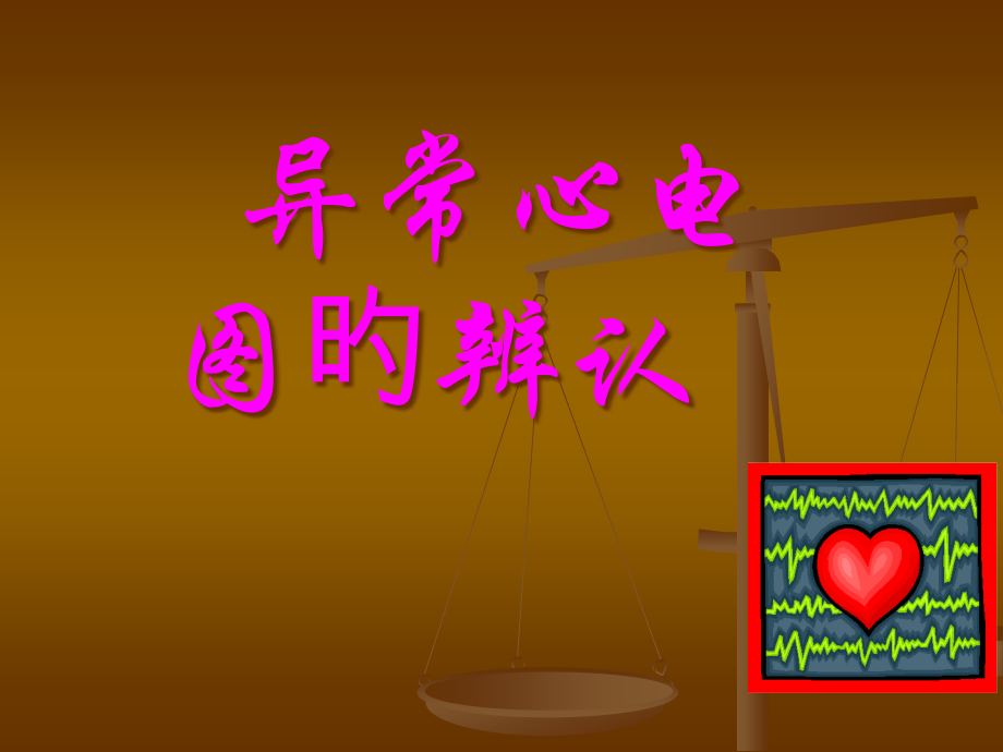 异常心电图的识别.pptx_第1页