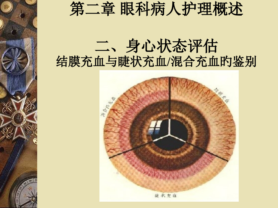 护理眼科检查.pptx_第2页