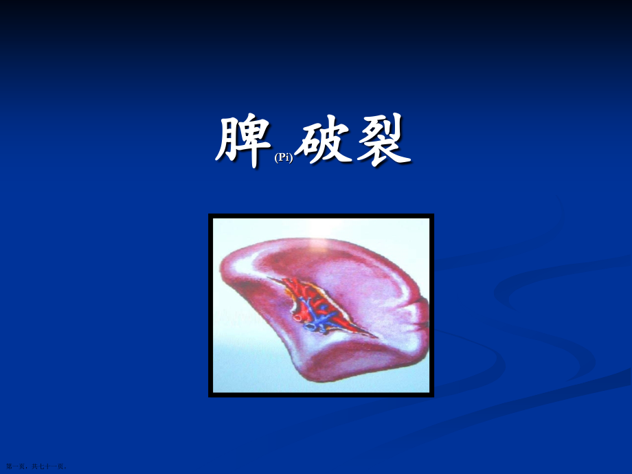 脾破裂临床分类护理及病例汇报.pptx_第1页