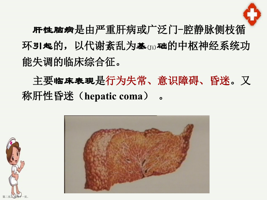 肝性脑病病人的护理与病例介绍.pptx_第2页