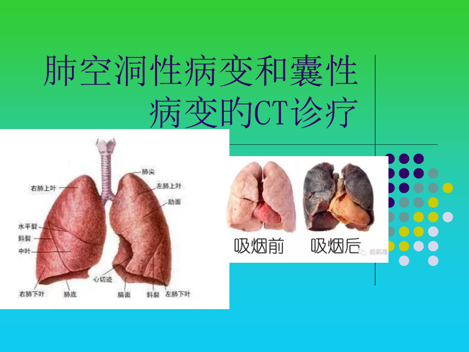 肺空洞性病变和囊性病变的CT诊断.pptx_第1页