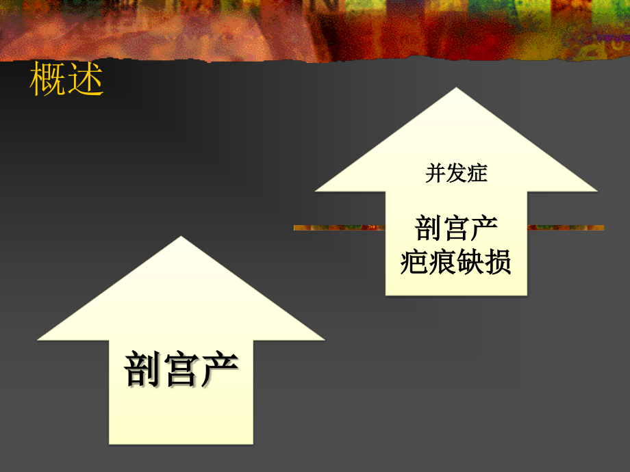 剖宫产术后宫壁缺损.ppt_第2页