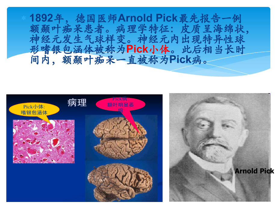 额颞叶痴呆合并运动神经元病).pptx_第2页