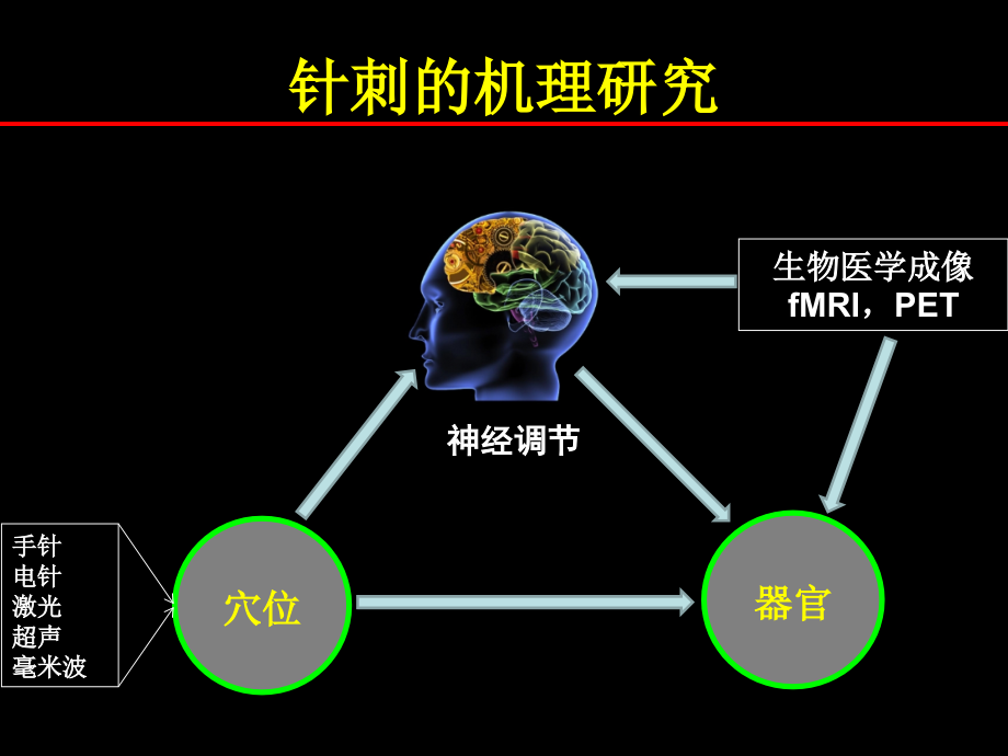 磁共振针刺成像技术研究.ppt_第2页