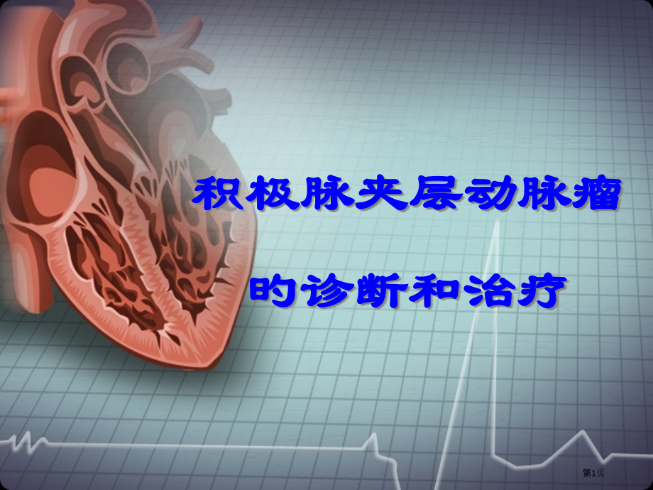 主动脉夹层动脉瘤的诊断和治疗.pptx_第1页