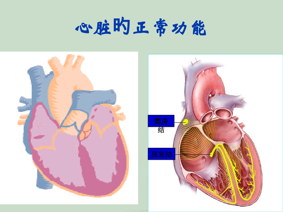 心律失常医学知识讲座.ppt_第2页