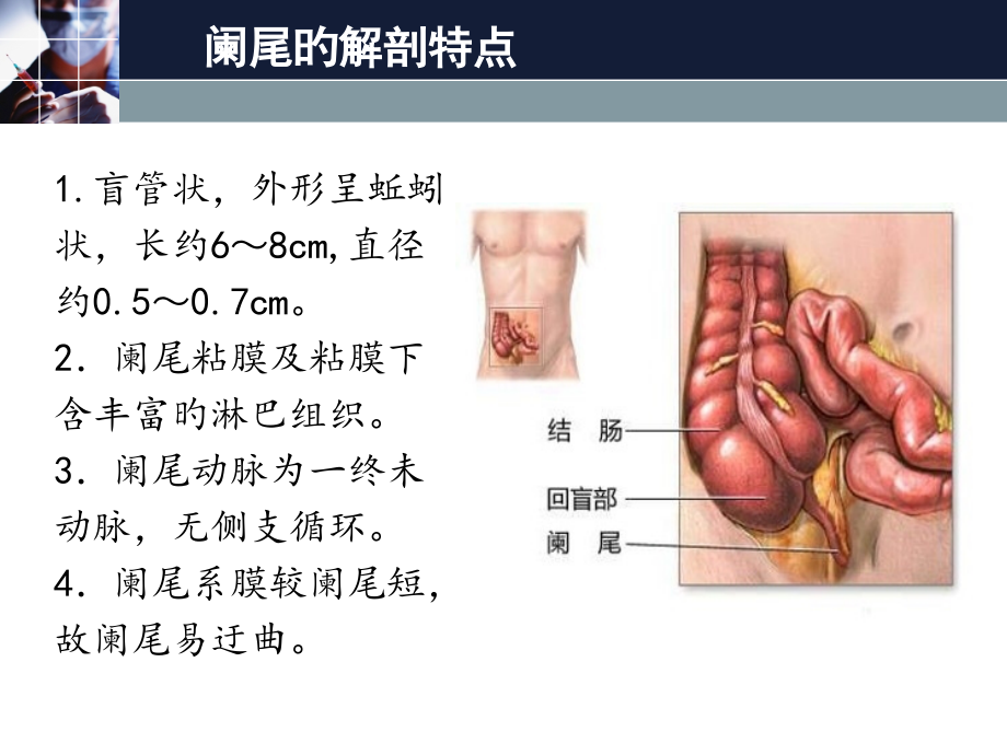 阑尾炎宣教专题知识宣讲.ppt_第2页