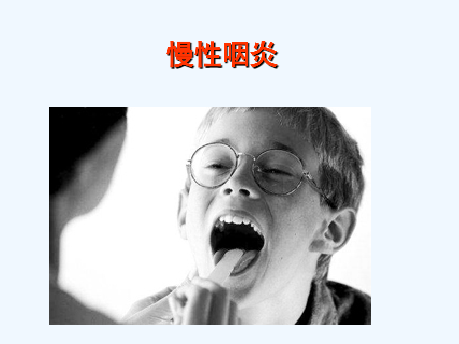 呼吸系统疾病防治慢性咽炎.ppt_第1页