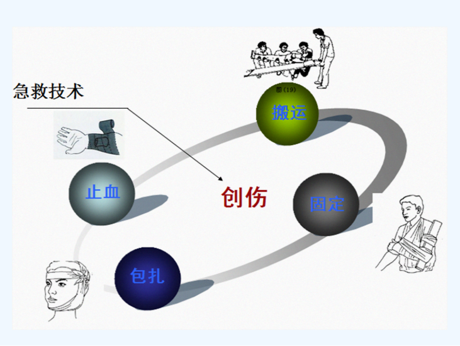 止血包扎技巧和步骤.ppt_第2页
