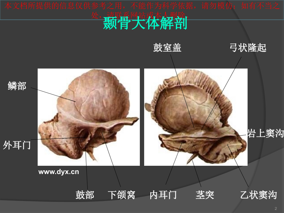 颞骨断层解剖和CT三维重建培训.ppt_第2页
