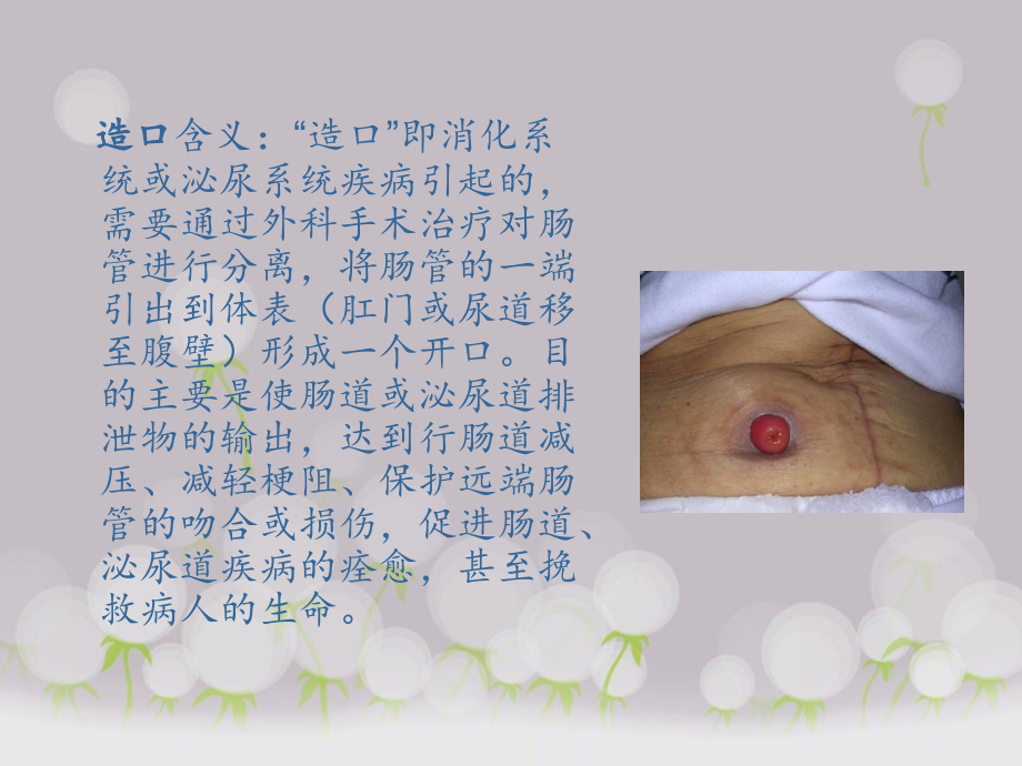 医学造口病人的生活医疗护理和指导建议专题课件.ppt_第2页