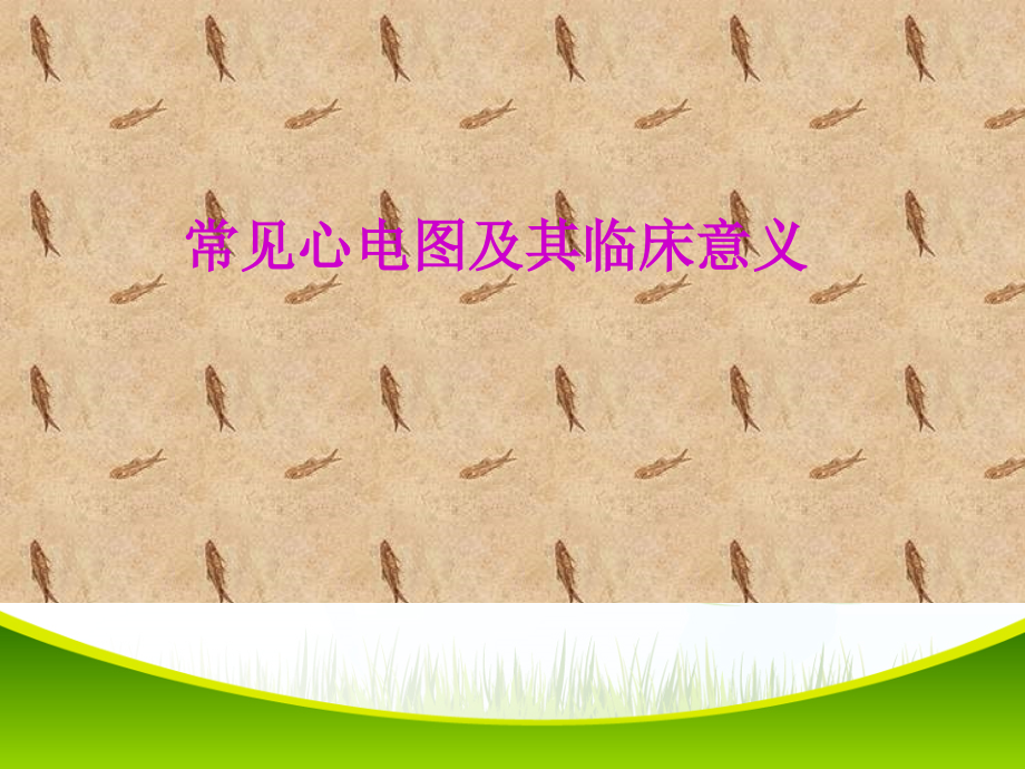 常见心电图及其临床意义.ppt_第1页