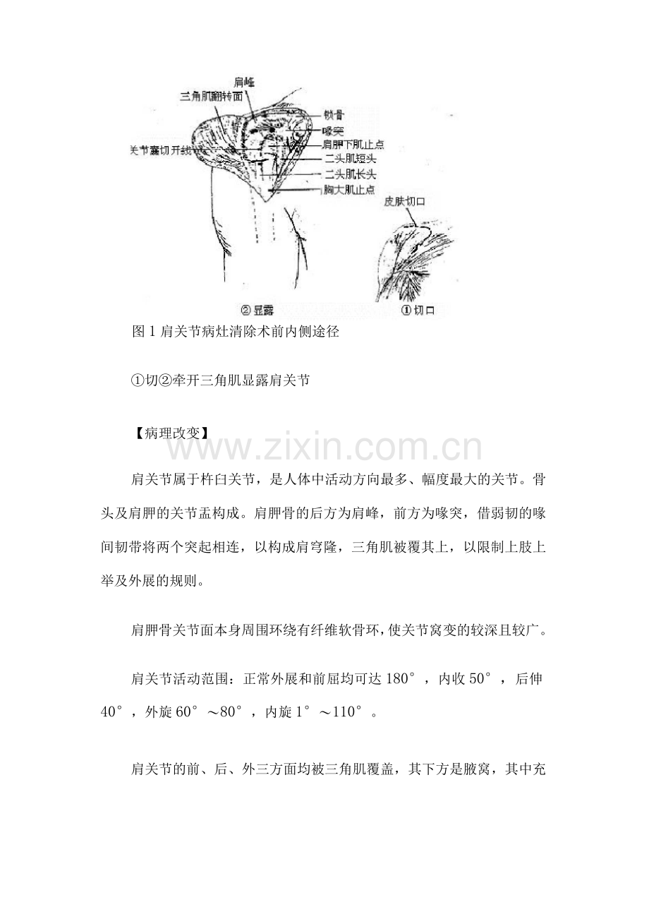 肩关节结核.docx_第2页
