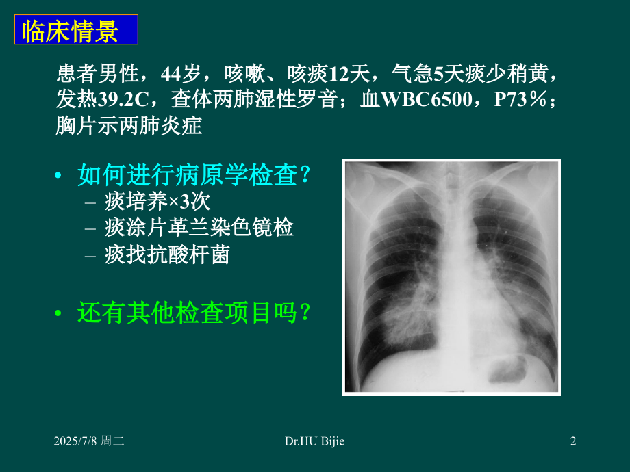 胡必杰肺部感染诊断难点病原学诊断的规范化和新技术.ppt_第2页