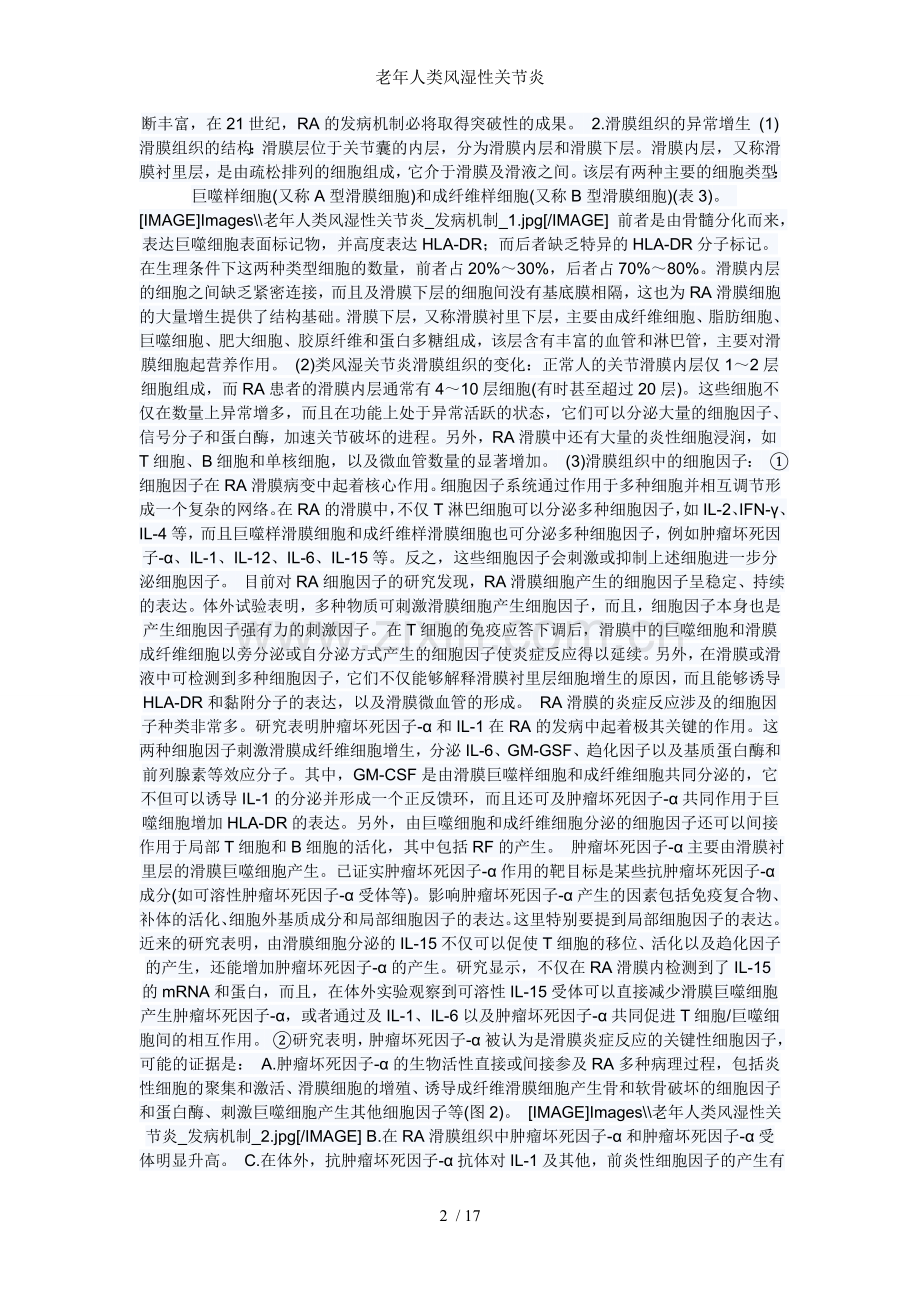 老年人类风湿性关节炎.doc_第2页