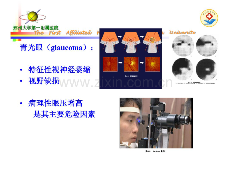 青光眼的药物治疗.pdf_第2页