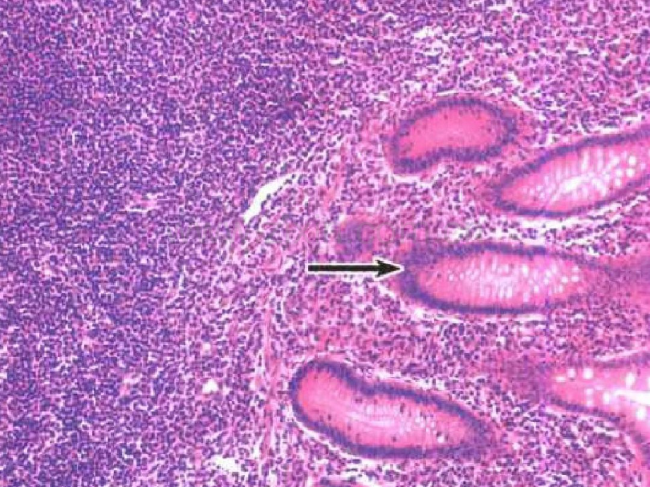 病理实验切片三炎症.pdf_第2页