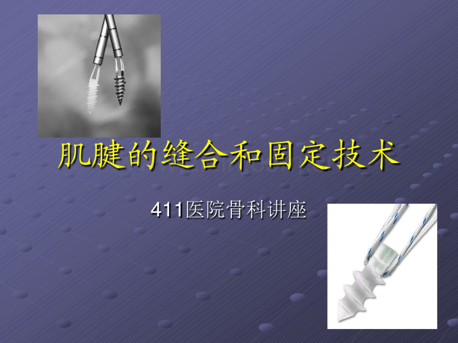 肌腱缝合技术.pdf_第1页