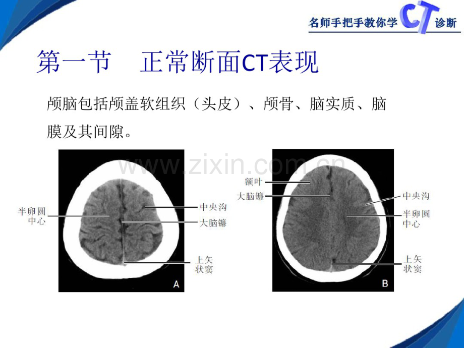 第二章颅脑.pdf_第2页