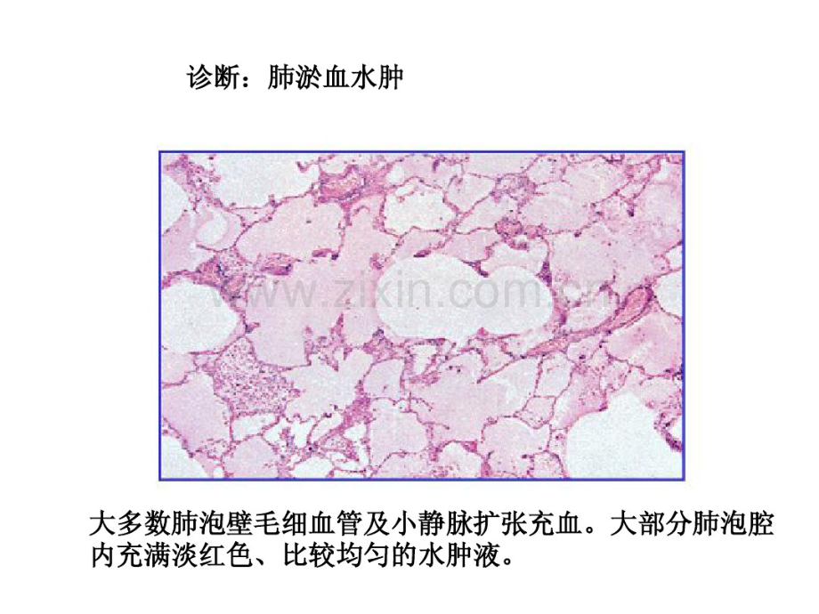 病理切片肺.pdf_第2页