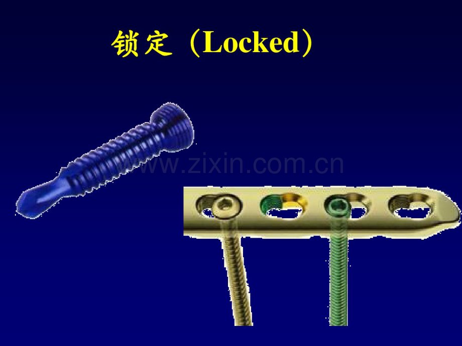 锁定接骨板技术.pdf_第2页