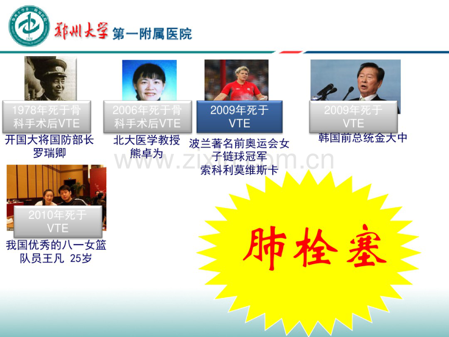 下腔静脉滤器的选择介绍.pdf_第2页