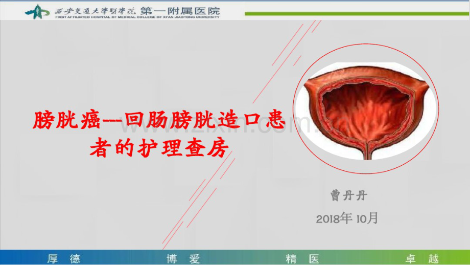 膀胱癌-回肠膀胱造口患者的护理查房.pdf_第1页