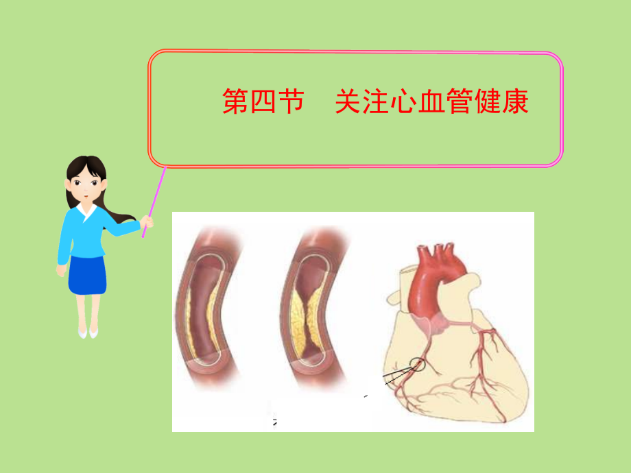 第三章-3-4-关注心血管健康.ppt_第1页