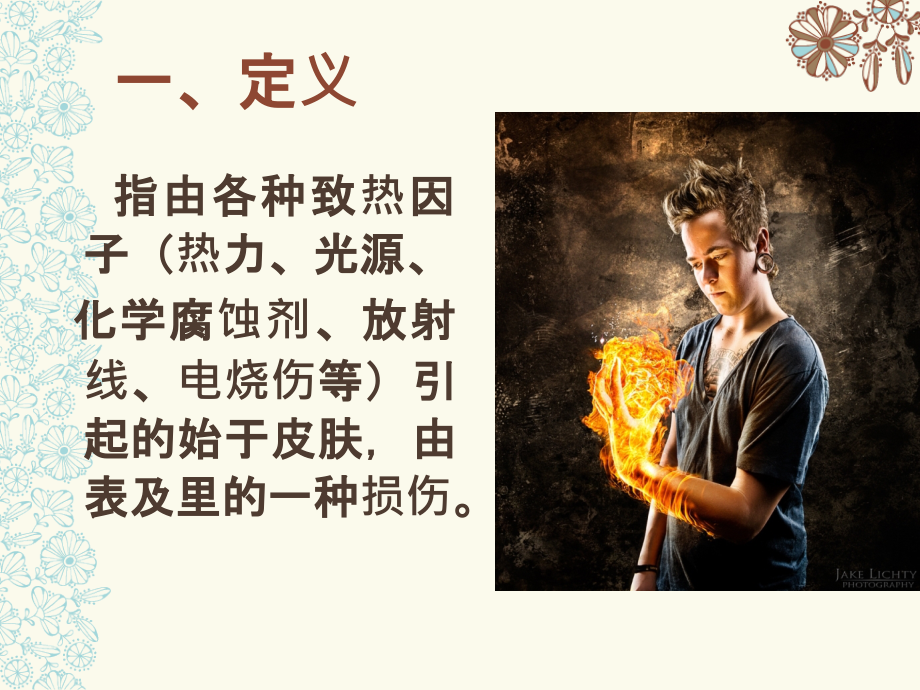 小儿烧伤护理.ppt_第2页