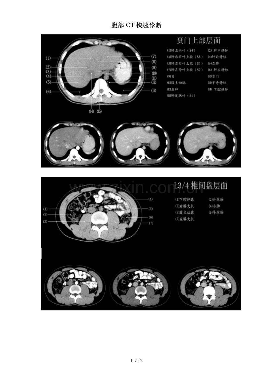 腹部CT快速诊断.doc_第1页