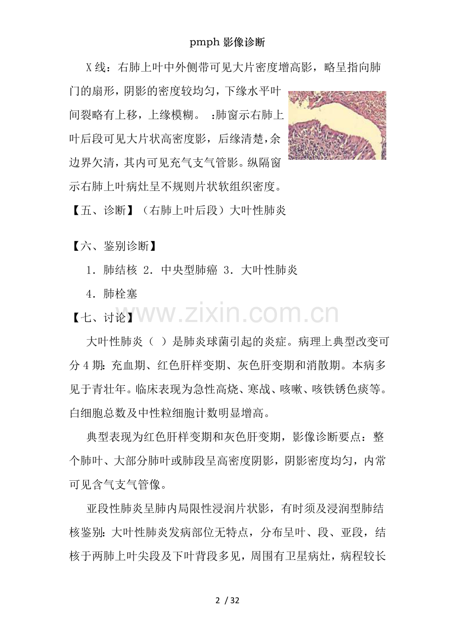 pmph影像诊断.doc_第2页