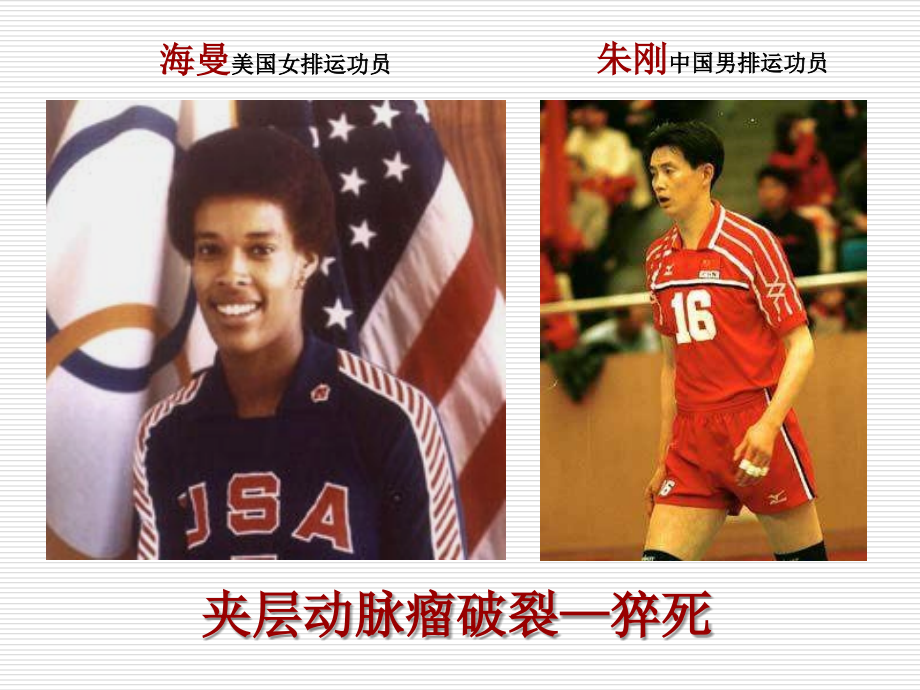 动脉瘤的外科手术及监护治疗.ppt_第2页