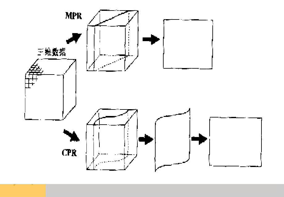 多平面重建MPR.ppt_第2页