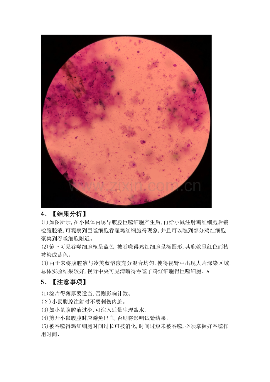 实验一巨噬细胞吞噬功能实验.doc_第2页