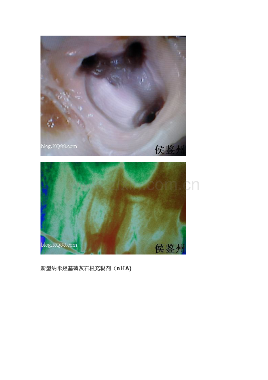 口腔常用材料.doc_第2页