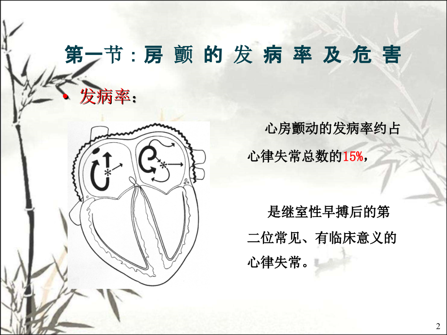心房颤动心电图.ppt_第2页