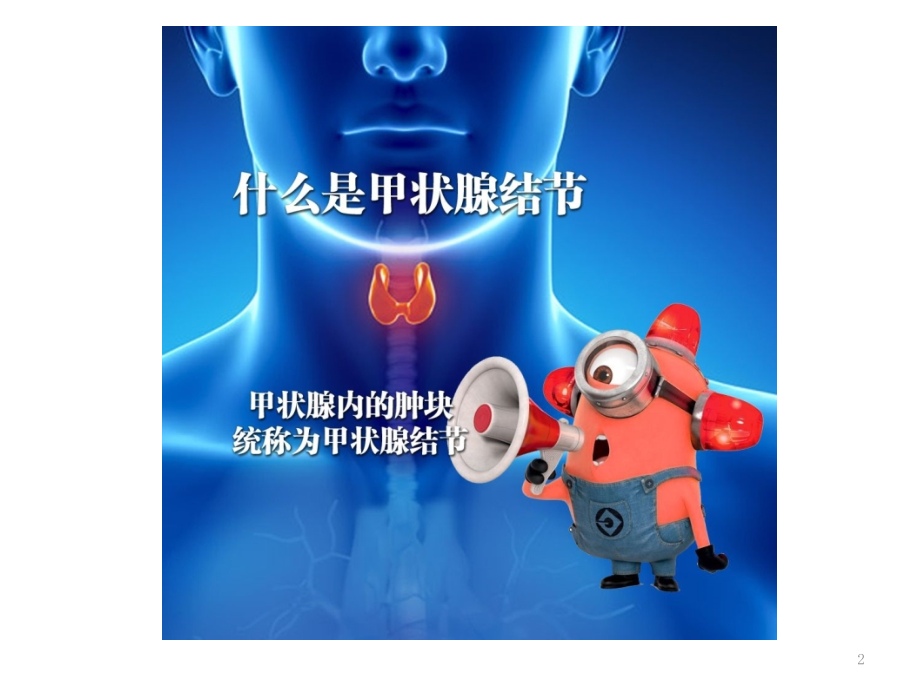 甲状腺结节科普课件.ppt_第2页