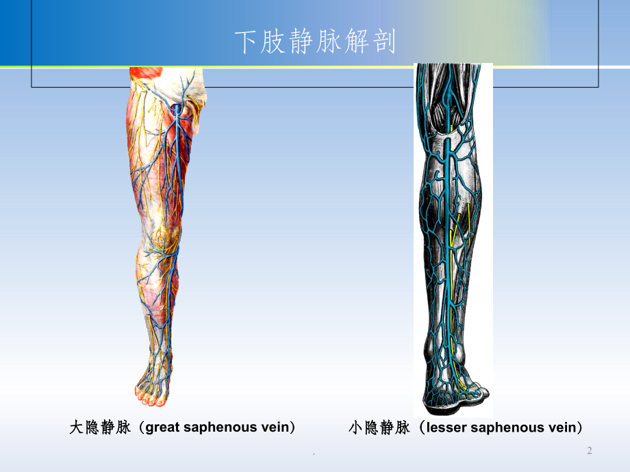大隐静脉曲张剥脱术PPT课件.ppt_第2页