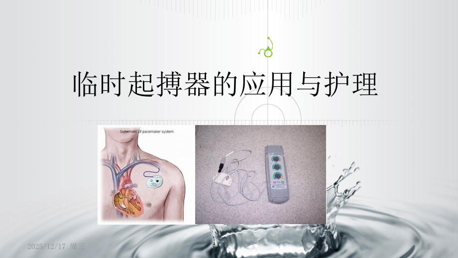 临时起搏器的应用与护理课件.ppt_第1页
