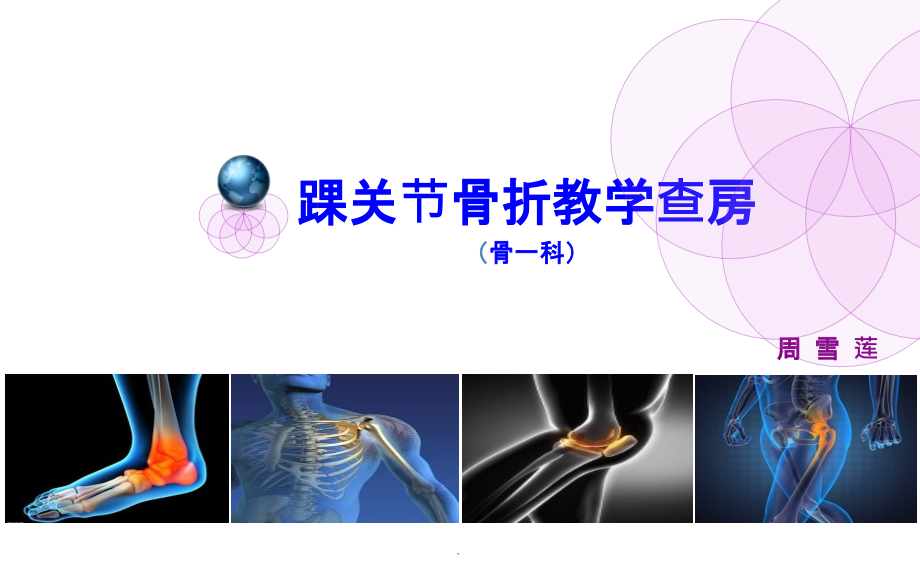 踝关节骨折课件.ppt_第1页