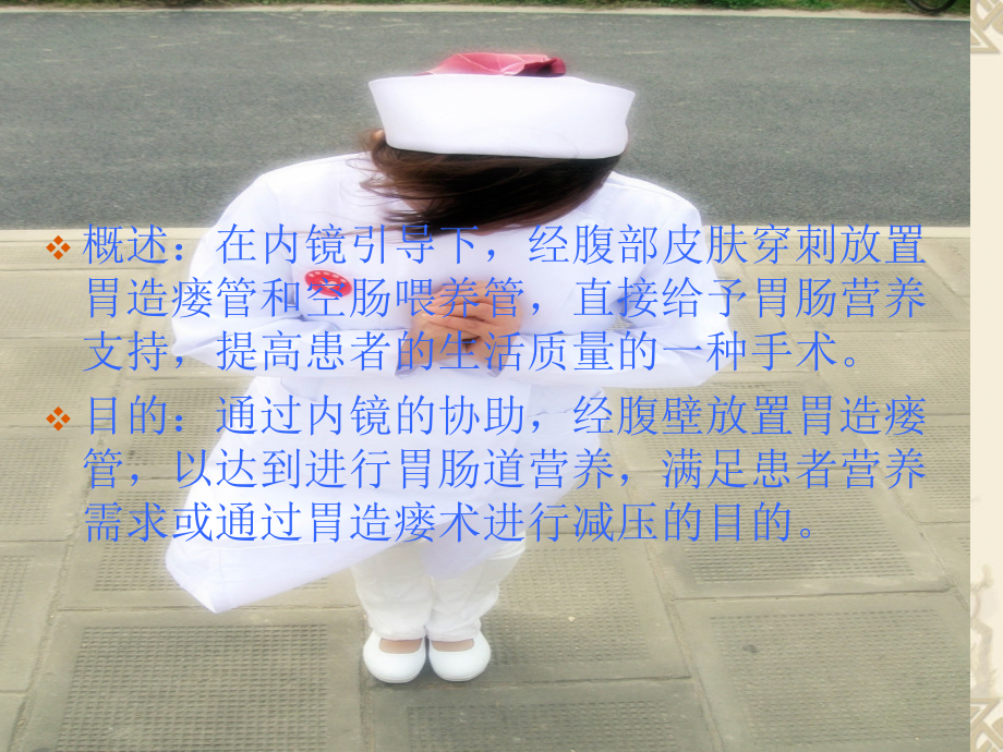 胃造瘘的护理课程.ppt_第2页