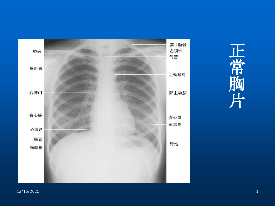 X线临床执业医师实践技能考试图片.ppt_第1页